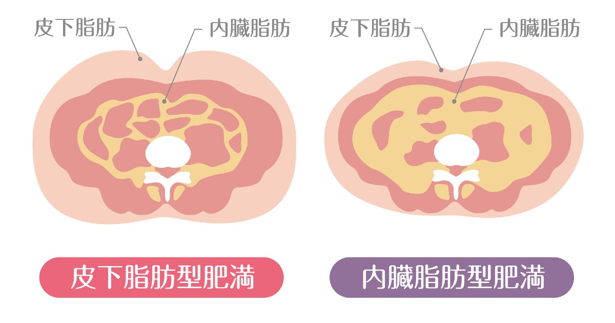 内臓脂肪と皮下脂肪の解説図（イメージイラスト）