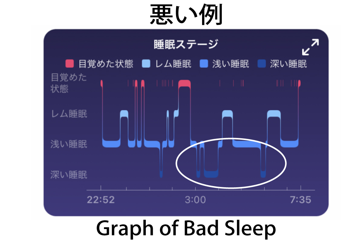 graph of bad sleep（睡眠グラフの悪い例）本人データ