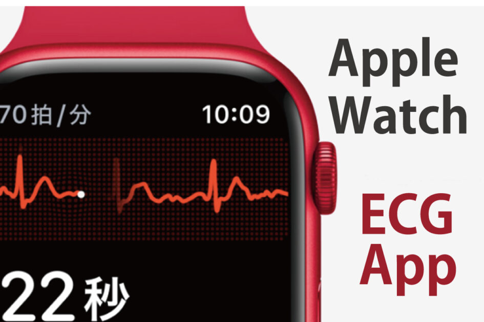 AppleWatch-ECG-App